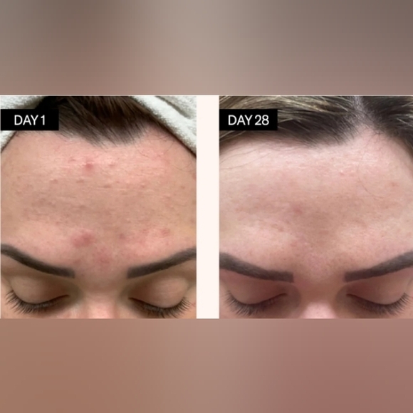 Odacite BL + C Black Cumin Cajeput Facial Serum Concentrate - Picture 4 of 5